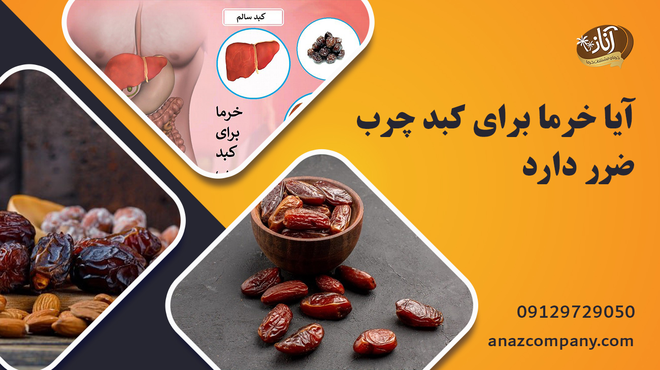 آیا خرما برای کبد چرب ضرر دارد